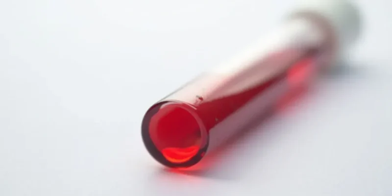 Ile kosztuje morfologia krwi? Ceny i zniżki na badania